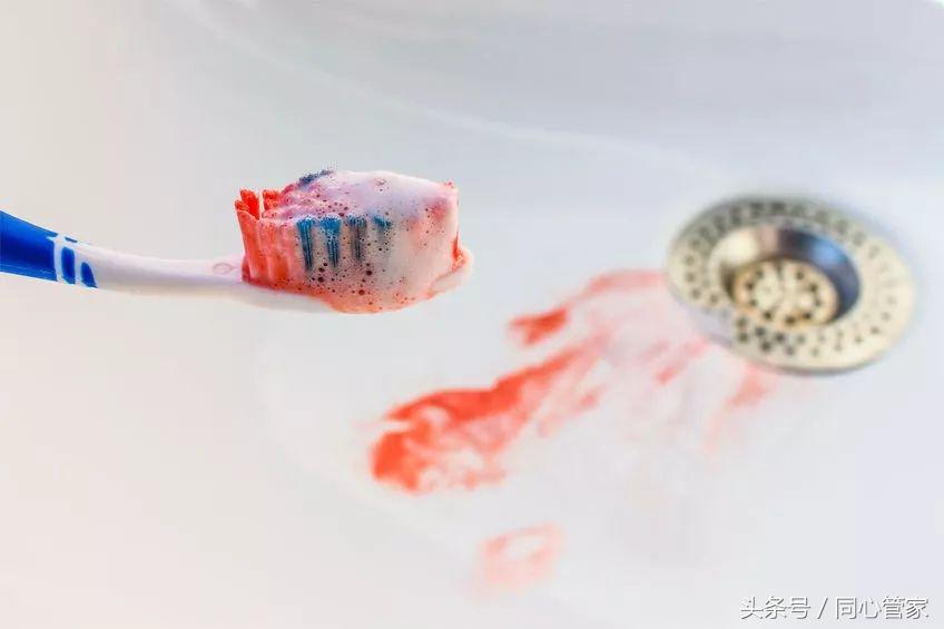 支架术后吃药轻微流鼻血,支架后流鼻血怎么办