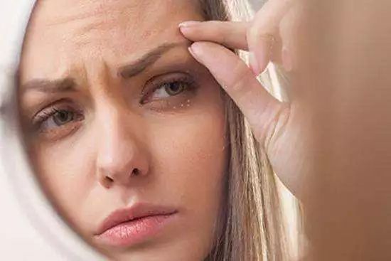 擦眼霜眼角长了脂肪粒,眼睛长脂肪粒和眼霜有关系吗