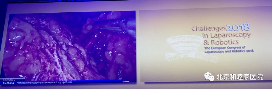 科普大赛腹腔镜手术机器人,腹腔镜及机器人手术