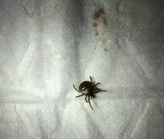 一家三口被刺身亡案,江苏一家三口被不知名虫子叮咬