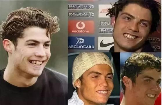 c罗整容了吗,c罗整牙颜值变化