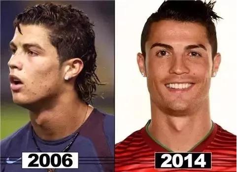 c罗容貌的变化,c罗整牙颜值变化