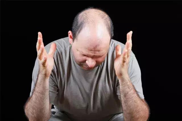 头顶日渐稀疏简单的生发技巧来了,头顶脱发用什么偏方生发