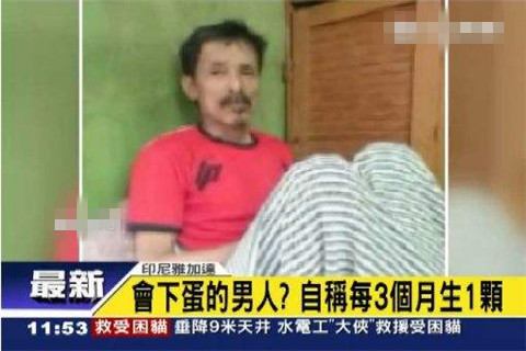 能下蛋的男人:印尼一男子竟每三月产蛋一次