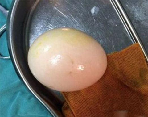 能下蛋的男人:印尼一男子竟每三月产蛋一次