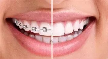 您的微笑，七月绽放——兖州区中医医院口腔科