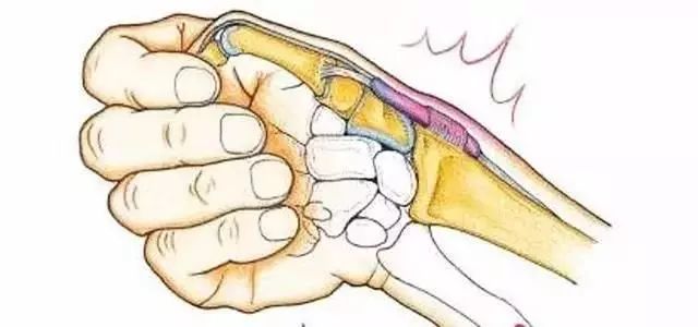 手残党必看,手残收藏