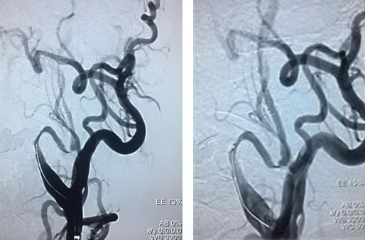 心血管内科急救流程,急诊静脉用药方法