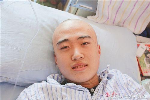 为什么化疗掉头发头皮疼,化疗掉头发有什么办法吗