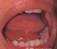 舌头出现这四种情况需要注意,舌头这3种表现多半是身体在报警