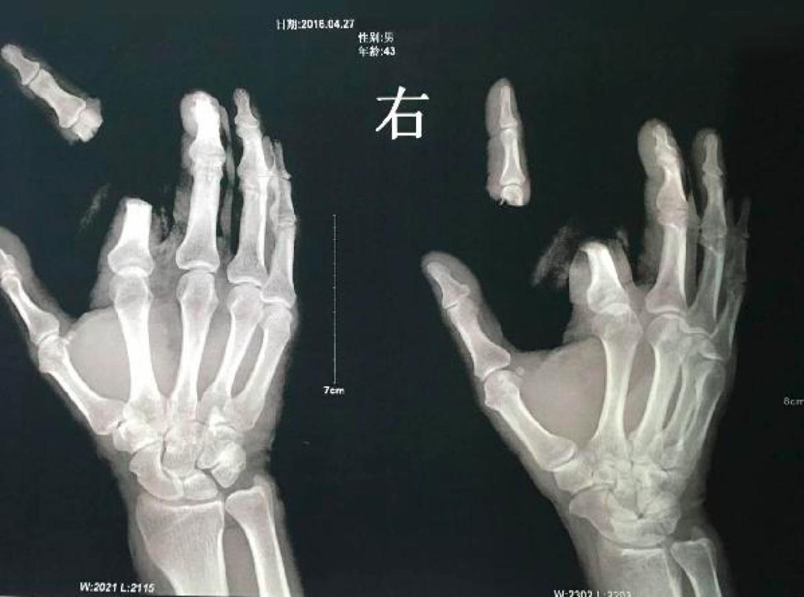 有剧毒的动物可以毁容吗,有剧毒又可怕的动物