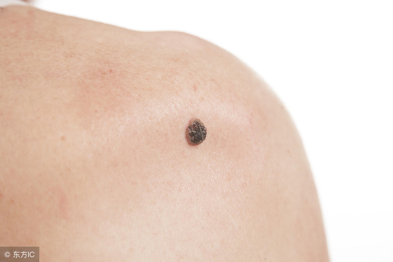 皮肤溃烂反复无法愈合癌症,皮肤溃烂伤口不愈合挂什么科