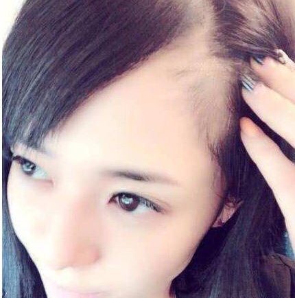 苍老师深夜不慎暴露身体缺陷，粉丝的评论却让她感动不已