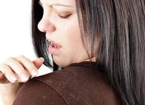 八大妙招轻松告别头皮屑烦恼，让你清爽无屑