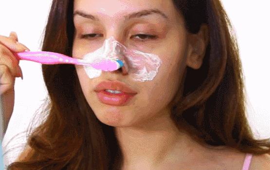 黑头已经有坑了怎么办,有黑头怎么处理方法最有效