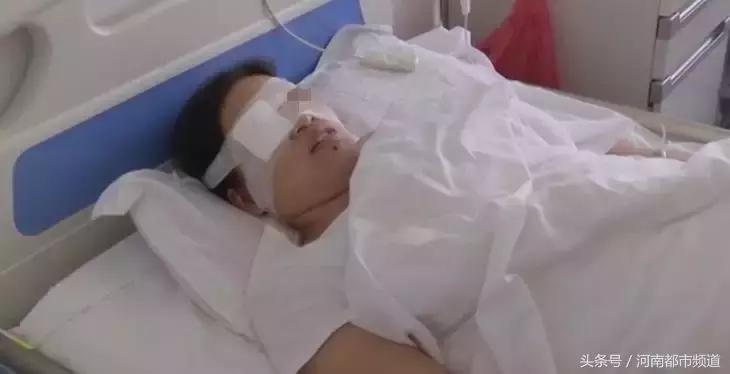 一女子发现眼睛看不清跑进寄生虫,一女子眼里藏条虫