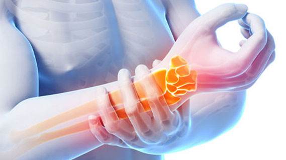 手机玩多了手腕疼用什么药膏,手机玩多了大拇指根部疼