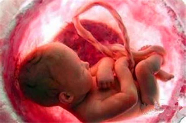 如果胎儿已经脐带绕颈怎么解决,胎儿脐带螺旋稍密集孕妈该怎么办