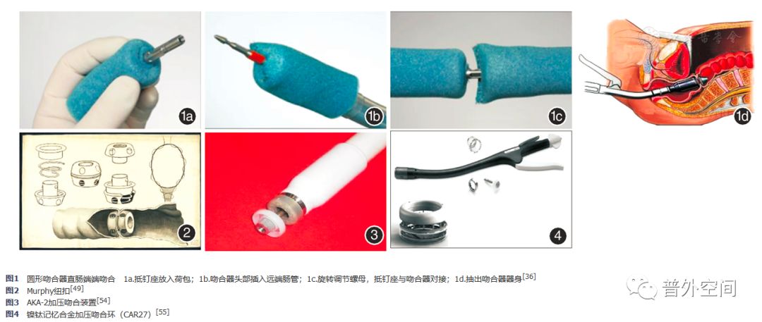 结直肠吻合器原理图,经腹腔行直肠切除吻合术概述