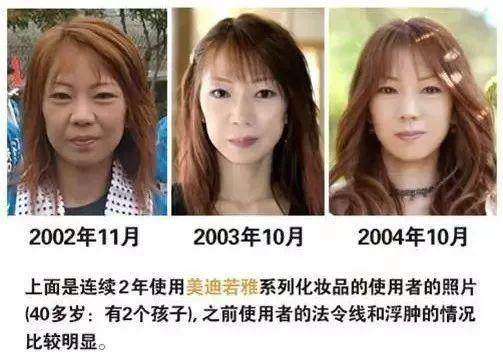 贵妇面膜淡化细纹,韩国贵妇面膜胶原蛋白很干