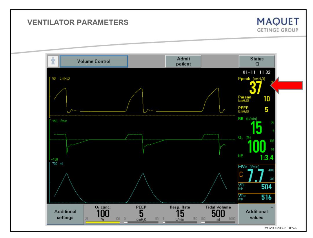 呼吸机模式和参数设置及临床意义,院前呼吸机模式及参数设置
