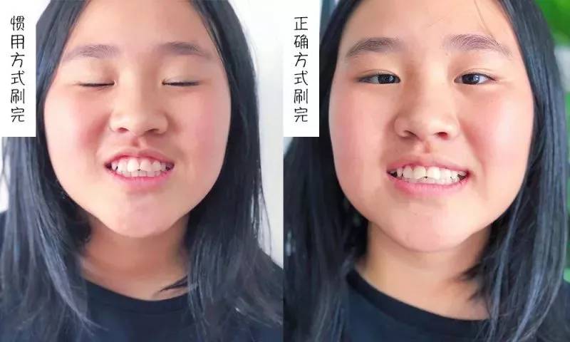 牙膏测评高露洁防蛀牙膏,牙膏推荐测评云南白药朗健