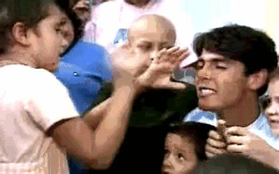 隆鼻手术后会不会一碰就变形,隆鼻术后假体移位怎么办