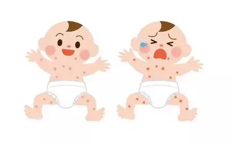 宝宝湿疹和痱子可不一样,这个方法学会了,对付湿疹最好了!