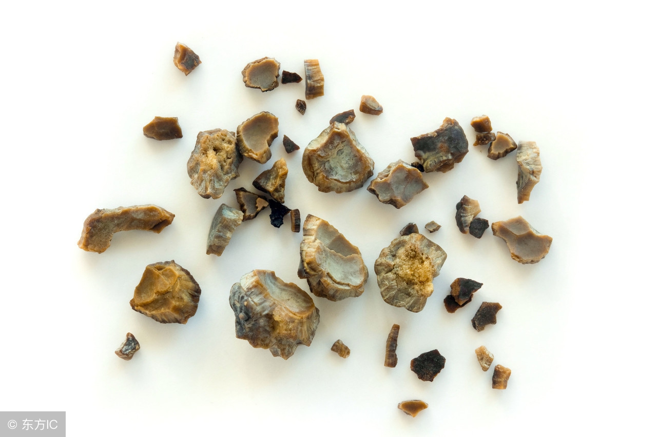 肾结石饮食要注意哪些食物不能吃,肾结石哪些食物不能吃要注意什么