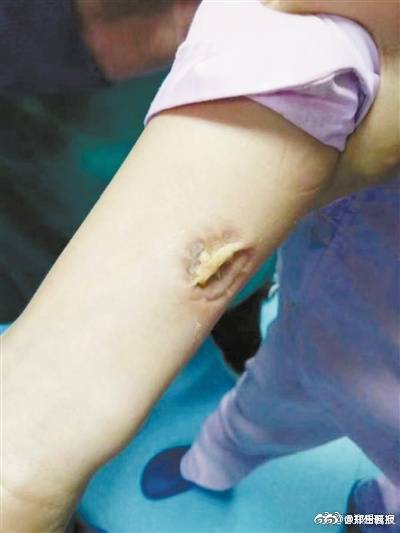 护士拿小孩插管痛苦撕心裂肺,护士看着病人疼痛难忍