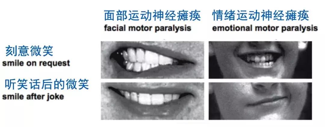 “假笑boy”的微笑，为什么看着那么假？