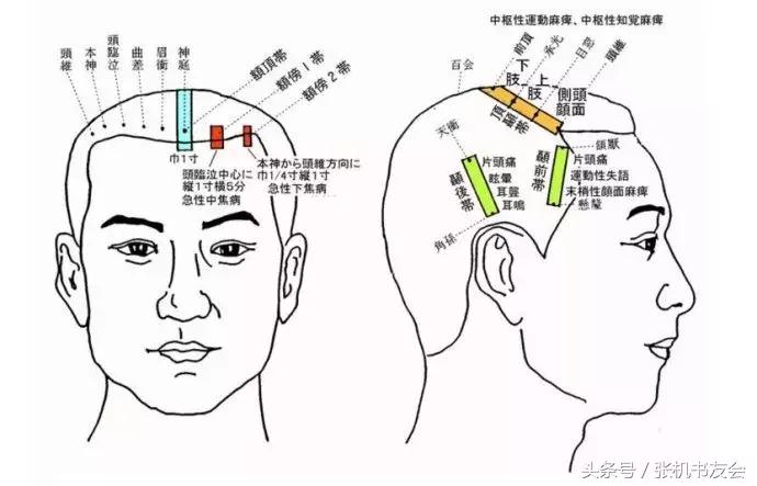 针灸按摩全息图（收藏版）