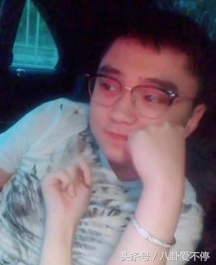 赵本山女儿球球整容的花费,爆料赵本山女儿球球