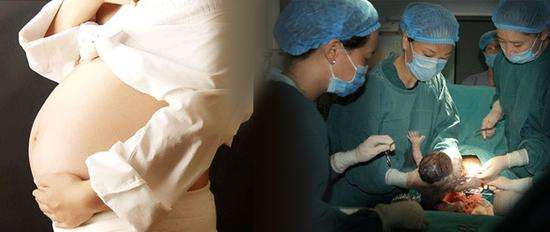 生孩子分娩有多痛最高达到几级,生孩子的时候有多痛