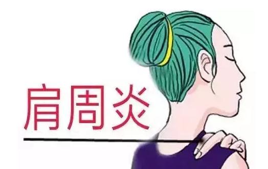 空调吹久了肩周炎复发怎么治,空调吹出的肩周炎能自愈么