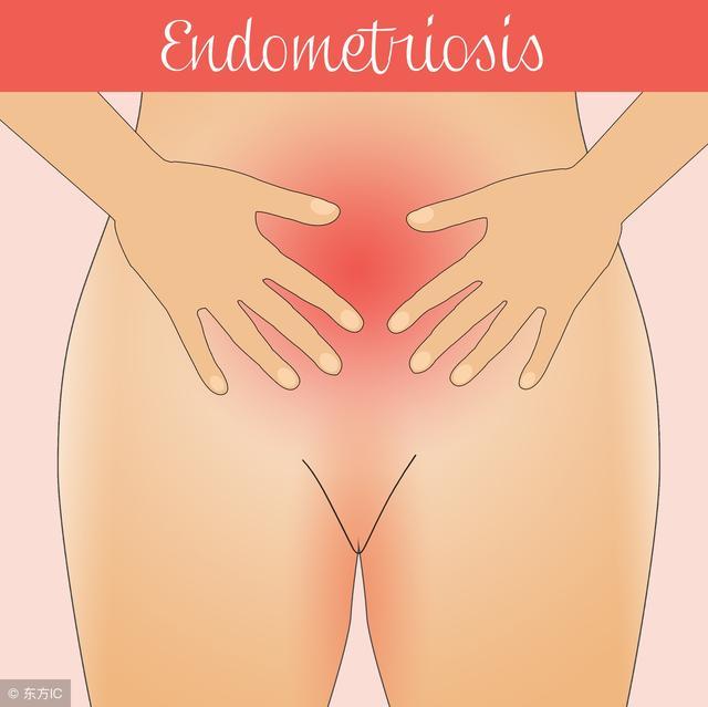 宫颈肥大到底是怎么回事？宫颈肥大如何防治好