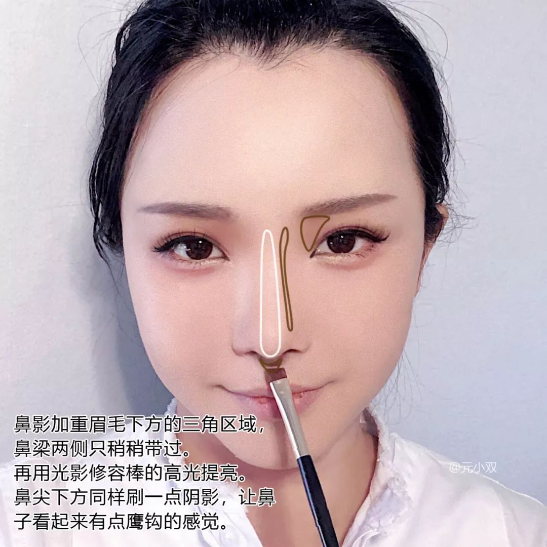 为什么三庭五眼眼距宽,眼距宽怎么改善做什么手术