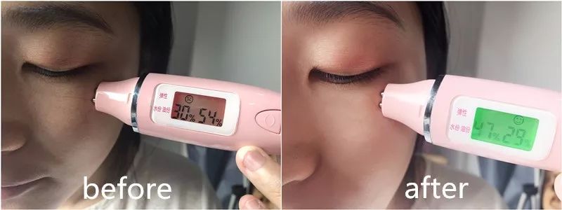 30岁眼角笑起来有皱纹,眼角笑起来有皱纹是老了吗