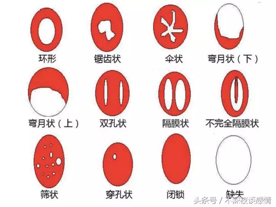 用什么方法可以鉴别是不是第一次