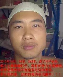 手淫3年，面貌早衰——戒手淫2年后改变！