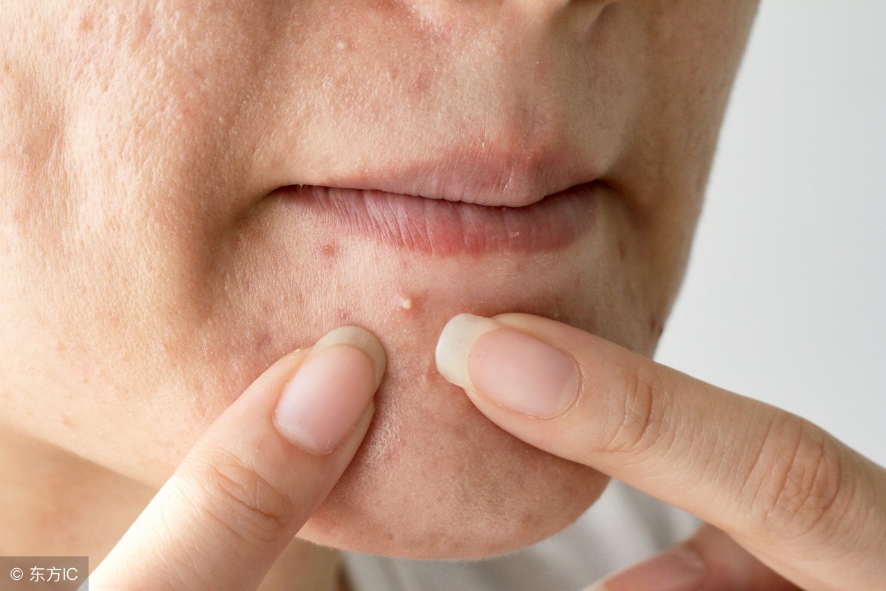 疮跟脓包有什么不一样,疮和疖什么区别