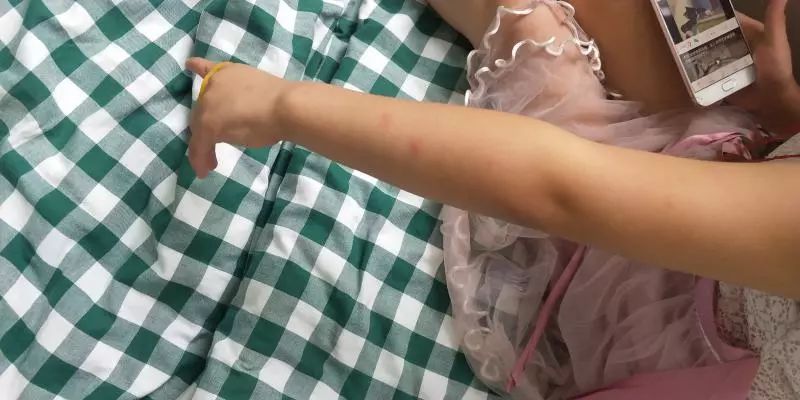 医院给一岁宝宝开了头孢,6岁女童头孢