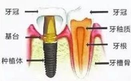 牙齿矫正8月最新价格,2024年30岁牙齿矫正费用多少钱