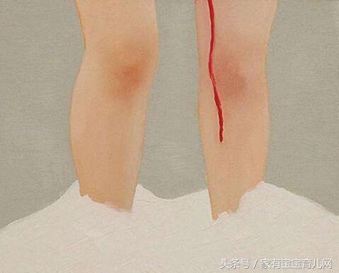 孕期见红会流产吗？有些出血很正常需要注意的是这5种情况！