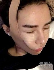 香蜜扑哧君黑历史,香蜜扑哧君被琉璃净火所伤