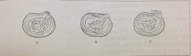 点穴疗法治腰椎间盘突出立竿见影,麦肯基腰椎间盘突出七步疗法图解