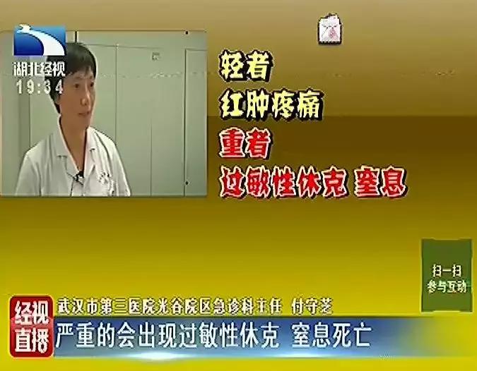 被蜂蛰了过敏性休克,被蜂蛰了去医院怎么医治