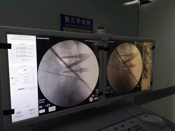 安阳市安钢总医院骨科专家,安钢医院脊柱微创中心主任名单