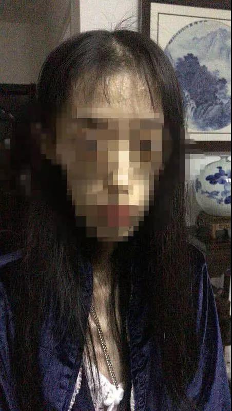 21岁女孩自杀式减肥只剩50斤照片不忍直视