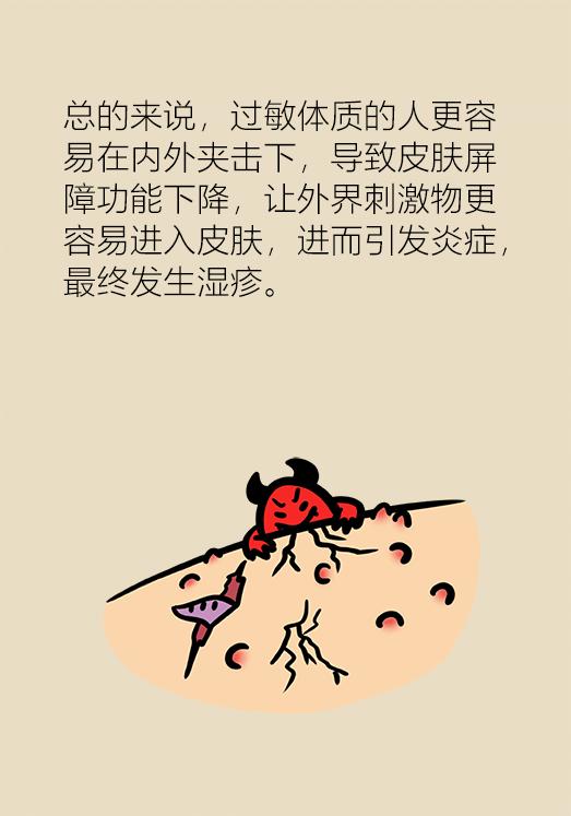 湿疹反复去医院挂哪个科,湿疹看西医反反复复怎么办